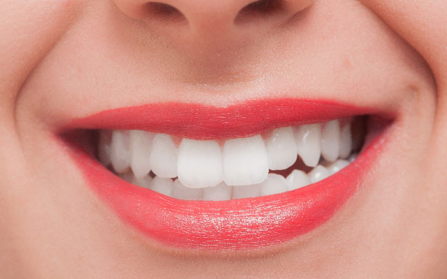 笑顔美人 キシリトール ミントオイル配合  超特価 ホワイトクリニック 白い歯  ポイント消化